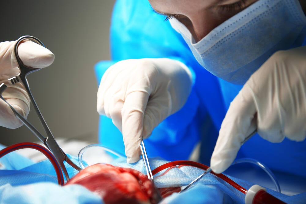 Operacija srca, Foto: Shutterstock