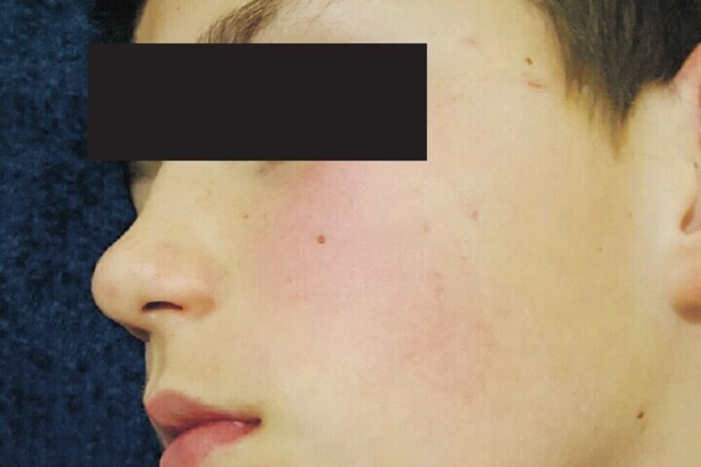 udareni dječak Kotor, Foto: Privatna arhiva