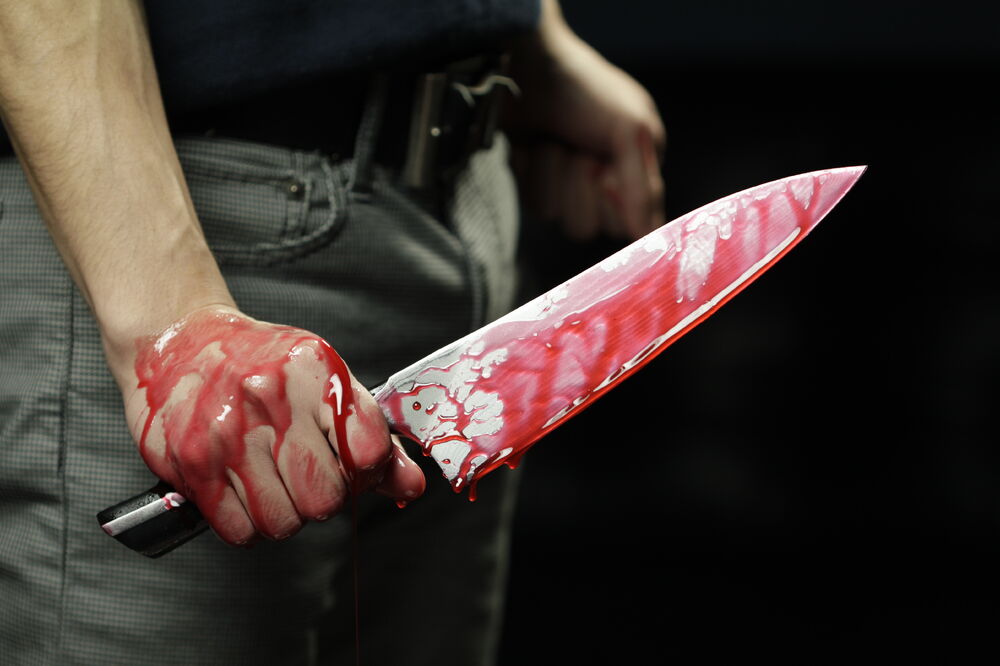 Nož, krv, Foto: Shutterstock