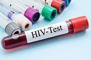 Besplatno i anonimno testiranje na HIV u Podgorici