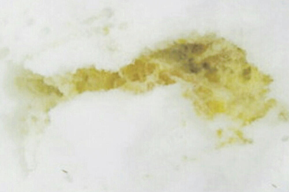 Trovanje pasa, Foto: A. Grbović