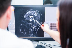 Nova tehnologija odstranjivanja tumora mozga
