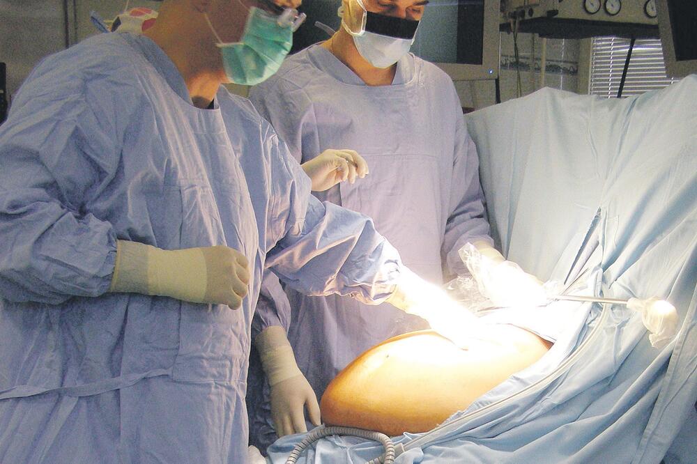 operacija gojaznosti, Foto: Miroslav Ilić