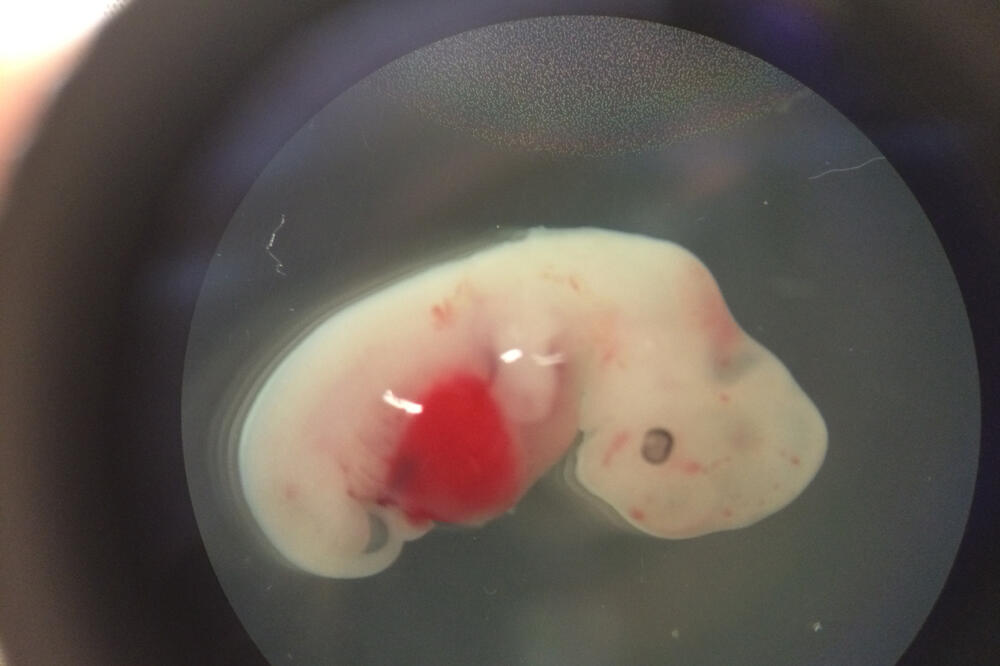 Embrion, Foto: Beta-AP