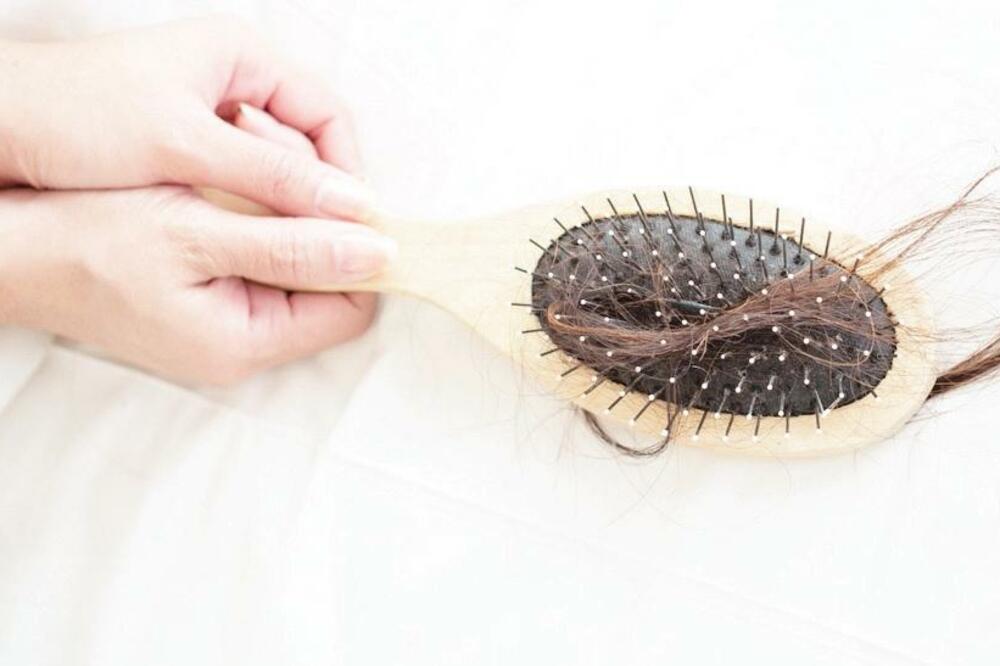 opadanje kose, Foto: Shutterstock.com