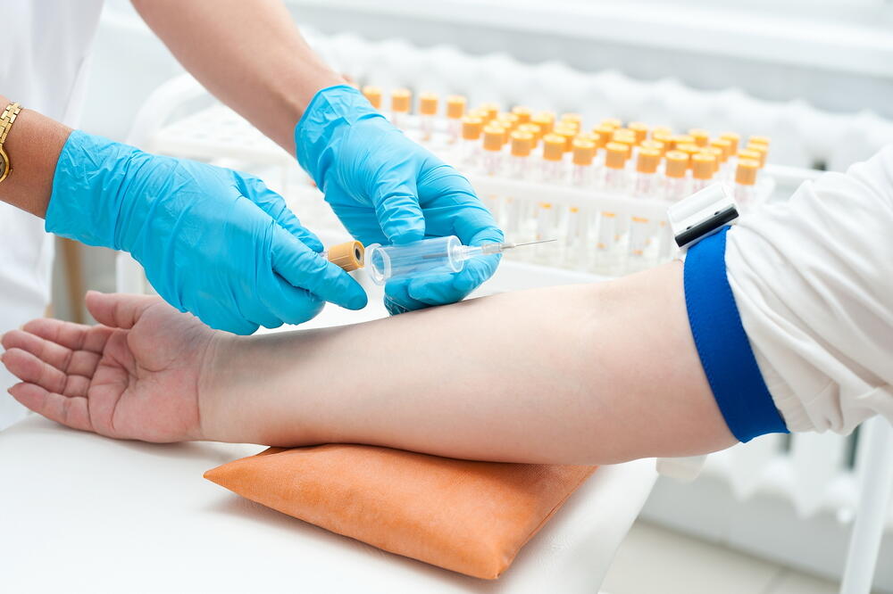 vađenje krvi, Foto: Shutterstock