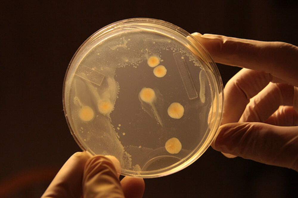 bakterija, Foto: Dickinsonn.ism-online.org