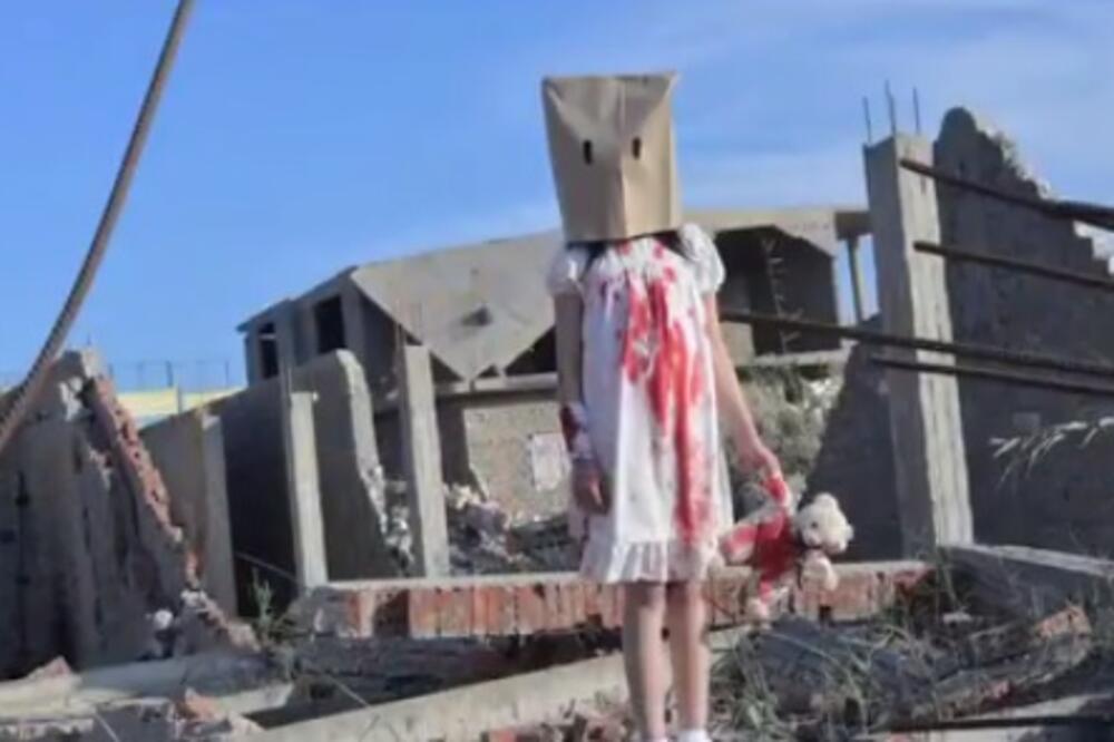 Lažna slika, dijete iz Alepa, Foto: Twitter