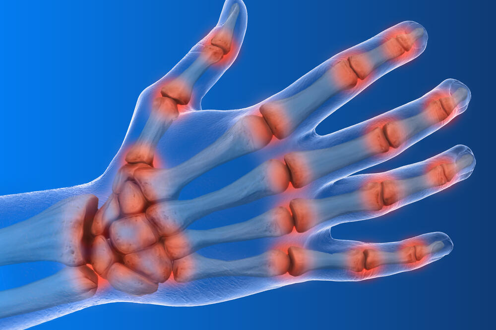 giht, Foto: Shutterstock