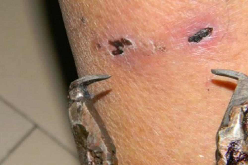 kliješta, ujed psa, Foto: Zivotinje.rs