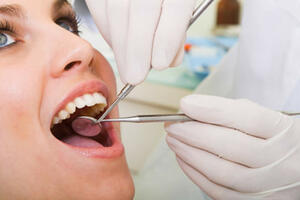 Koliko često treba prati zube i ići kod zubara?