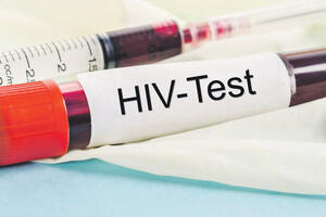 HIV je hronična bolest, ne moralna kategorija!