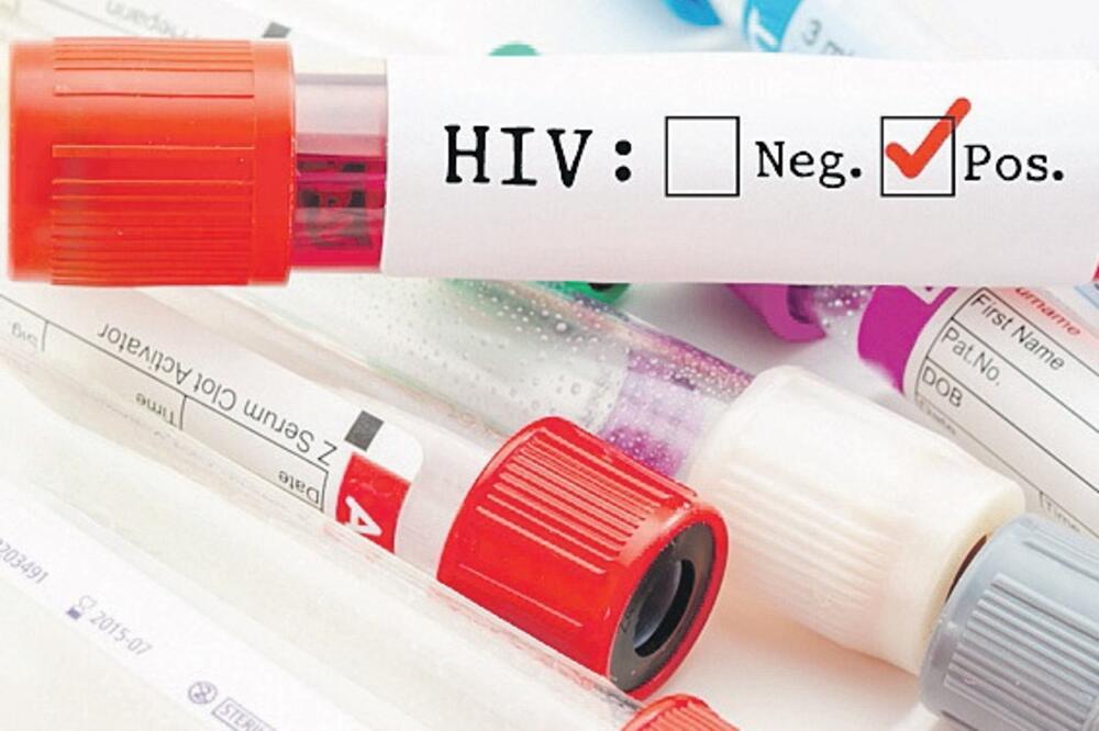 hiv, Foto: Shutterstock