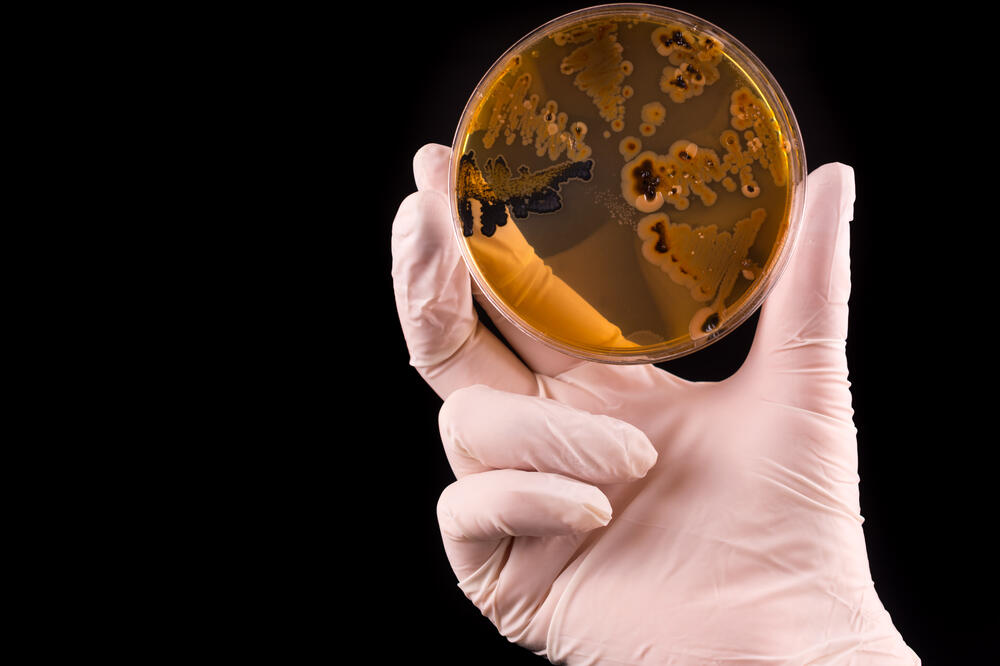 salmonela, Foto: Shutterstock