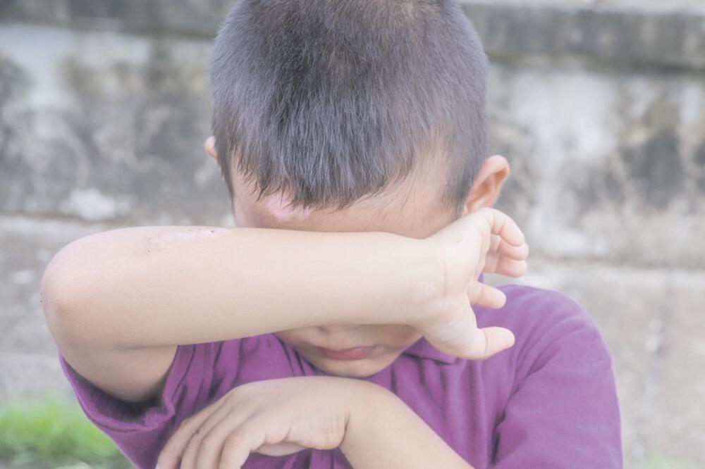 napad na maloljetnika, Foto: Shutterstock