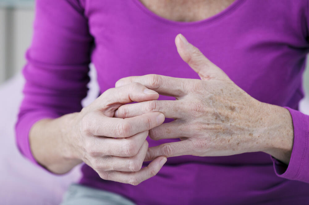 artritis, Foto: Shutterstock