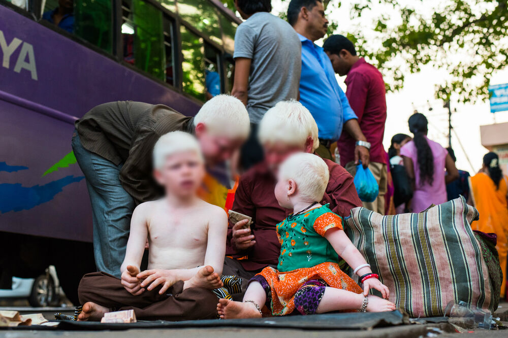 albino, Foto: Shutterstock