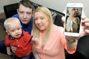 Od ovog dječaka svi bježe na ulici, a on i dalje čeka lijek