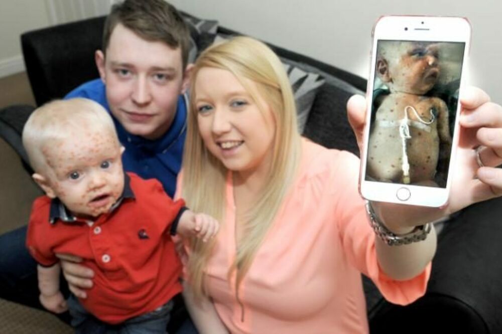 dječak, boginje, Foto: Telegraph.co.uk