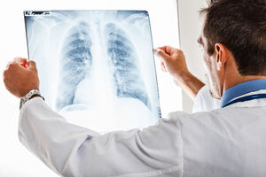 Zašto rak najčešće napada pluća i kosti?