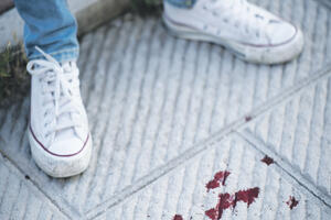 Slomio nos policajcu