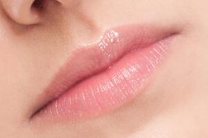 Obolijevalo se i od poljupca