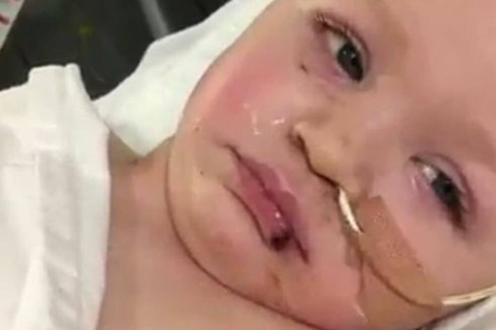 Met Dauson, Foto: Twitter