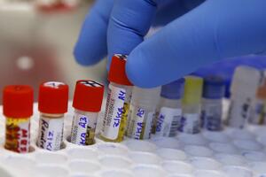 Virus zika potvrđen u Irskoj