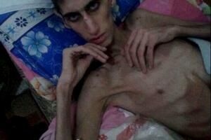 Madaja: Od gladi umrle najmanje 32 osobe