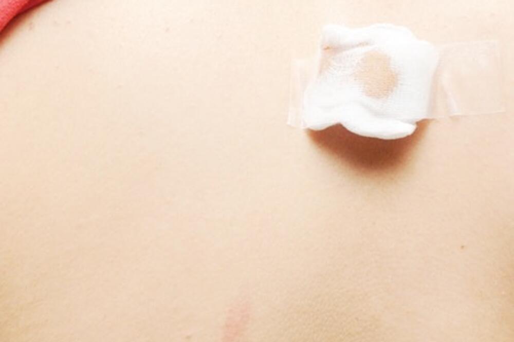 JJ Ilija Mandić tuča, Foto: Savo Prelević