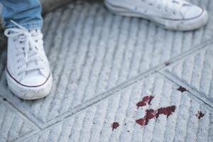 Pretučen Suad Gruda, otac tvrdi da se zna ko je napadač