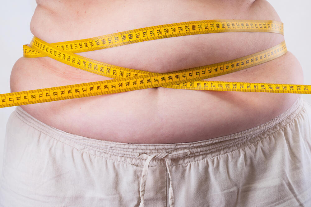 Gojaznost, Foto: Shutterstock