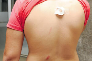 “Tukao me je šipkom, a ne pesnicama”