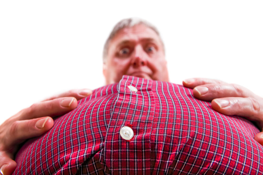 gojaznost, debljina, Foto: Shutterstock