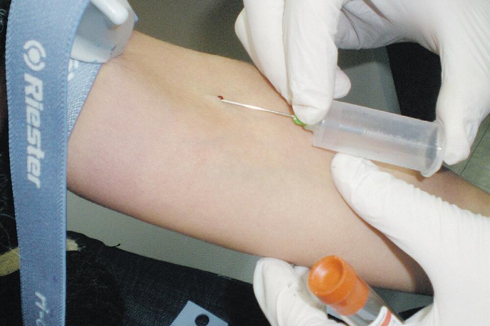vađenje krvi, laboratorija, Foto: Vijesti