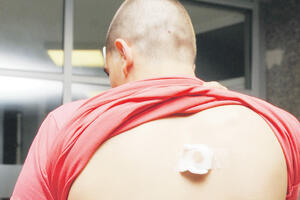 Optuženi tvrdi da je udarao pesnicom, a ne šipkom