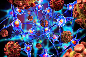 Revolucija u liječenju raka: Ćelije tumora će "loviti" virusi