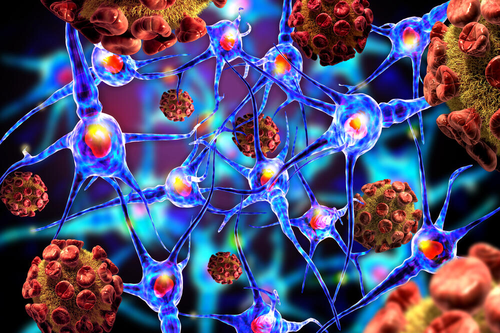 tumor, virus, Foto: Shutterstock