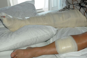 Lakovića ranili pa onda tukli