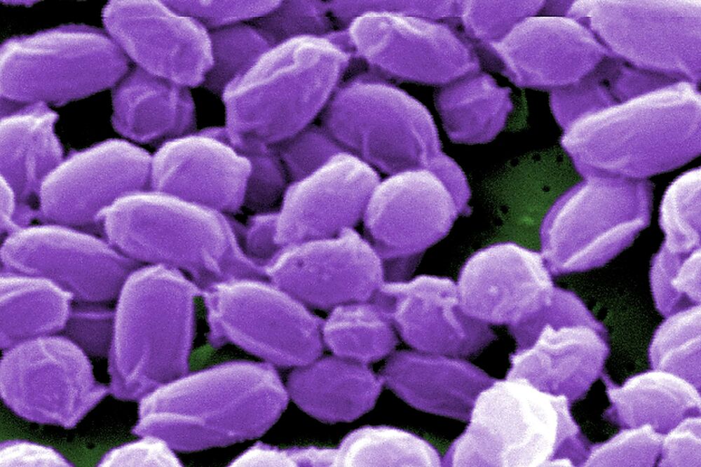 Antraks, Foto: Reuters