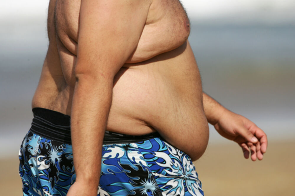 debljina, gojaznost, Foto: Shutterstock.com