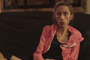 10 godina borbe s anoreksijom, danas ima 19 kilograma, a ovo je...