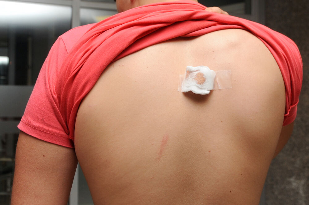 Pretučeni mladić, Foto: Savo Prelević