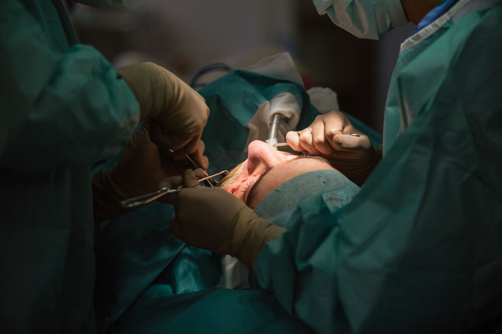 Hirurg, operacija, Foto: Shutterstock