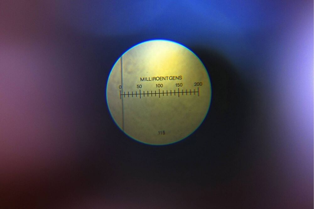 Radijacija, Foto: Beta/AP