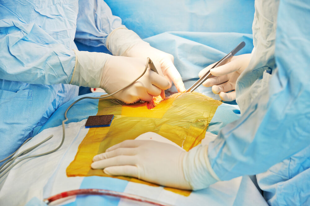 transplantacija, Foto: Shutterstock