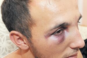 Moračanin nije tukao policajce