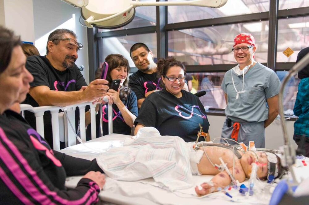 Hjuston, sijamske bliznakinje, Foto: Janet Shamlian/Twitter