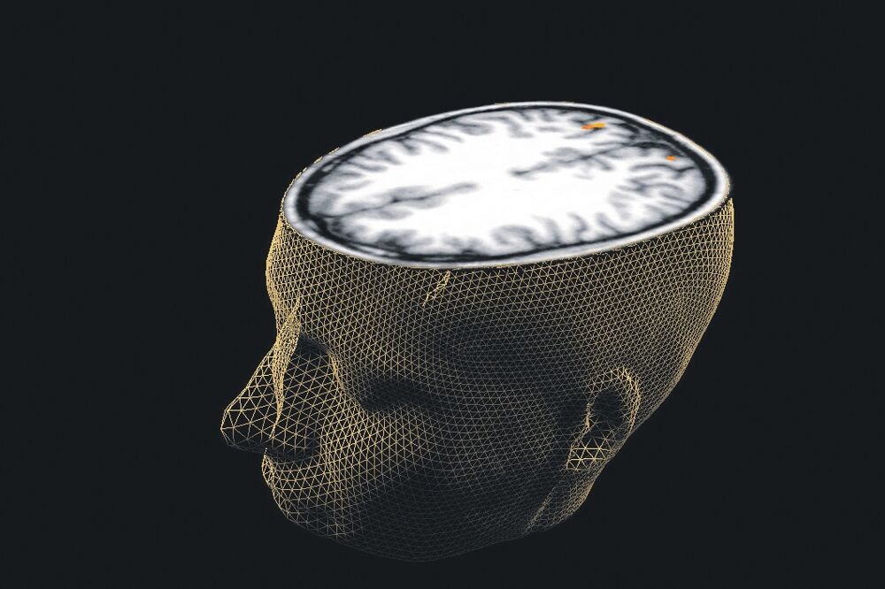 Mozak, Foto: Reuters