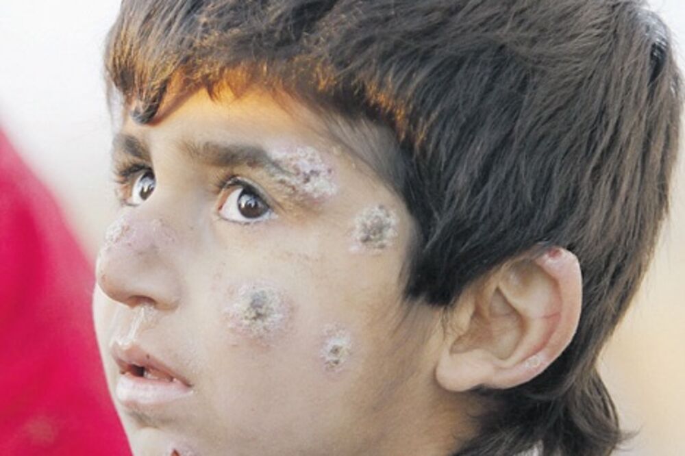 Dječak iz sekte Jazidi, Foto: Reuters